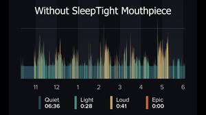 results-of-not-wearing-sleeptight-mouthpiece