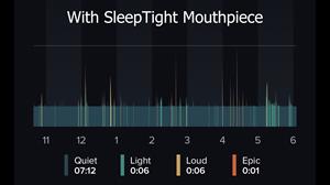 results-wearing-sleeptight-mouthpiece