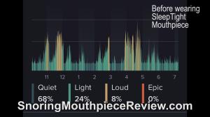 sleeptight-mouthpiece-before-wearing