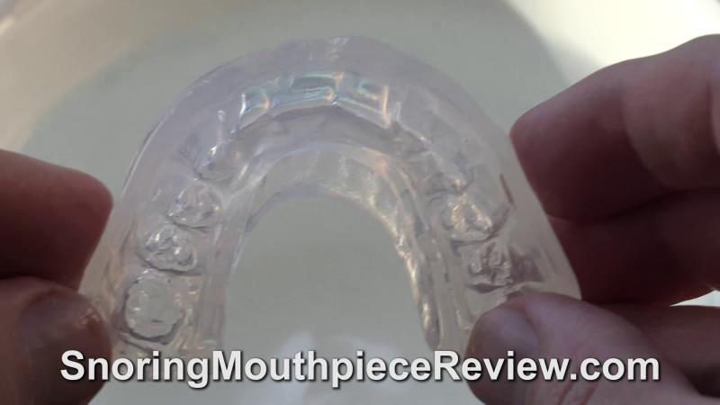 impressions of teeth in SleepTight Mouthpiece
