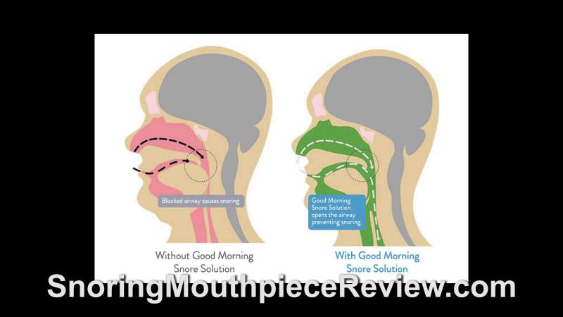how good morning snore solution works