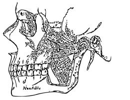 A diagram of the temporomandibular joint, showing the upper and lower teeth, jaw joint, and jaw muscles
