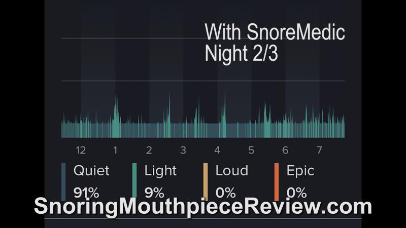 snoremedic night 2