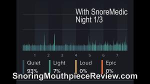 wearing-snoremedic-night-1-of-3
