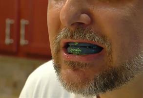 A person wearing NBC Rossen Report snoring mouthpiece, one of the real-life success stories for snoring relief.